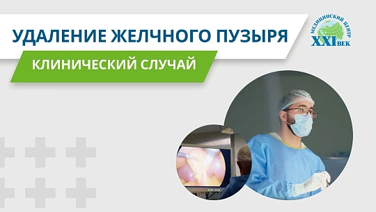 Удаление желчного пузыря. Клинический случай